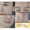 Kose Grace One Wrinkle Care Concentrate Spots Mask | StoreJPN anti-wrinkle spot pads